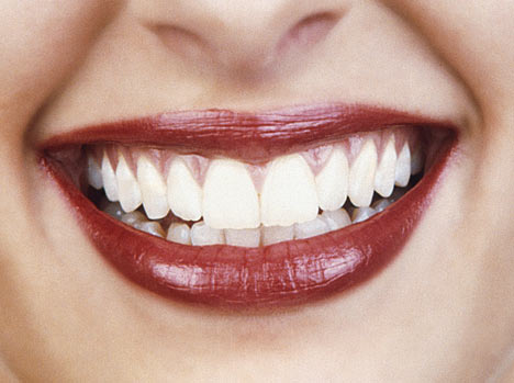 Beauteeth: Attractive Smile Start From Simple Thing