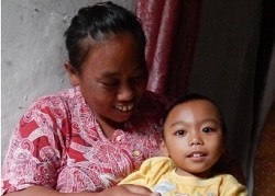 celebral palsy